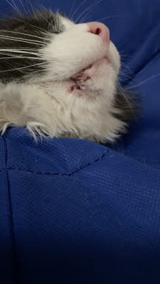 After some elective surgery